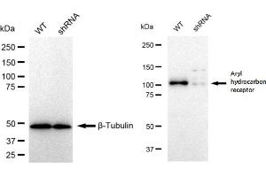 Western blotting analysis using Aryl hydrocarbon receptor antibody (ABIN7797656). (Rekombinanter Aryl Hydrocarbon Receptor Antikörper)