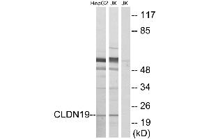 Western blot analysis of extracts fromHepG2 cells and Jurkat cells, using CLDN19 antibody. (Claudin 19 Antikörper)