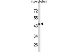 Western Blotting (WB) image for anti-Fibromodulin (FMOD) antibody (ABIN3004097) (Fibromodulin Antikörper)