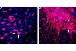 Expression of LINGO-1 in rat brain and spinal cord - Immunohistochemical staining of perfusion-fixed frozen rat brain sections using Anti-LINGO-1 (extracellular) Antibody (ABIN7043298, ABIN7044790 and ABIN7044791), (1:400), followed by donkey-anti-rabbit-Cy3. (LINGO1 Antikörper  (Extracellular, N-Term))