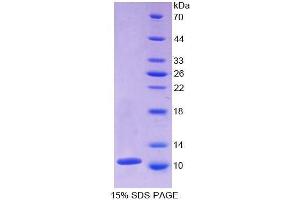 SDS-PAGE (SDS) image for Pro-Platelet Basic Protein (Chemokine (C-X-C Motif) Ligand 7) (PPBP) (AA 40-113) protein (His tag) (ABIN1078970)