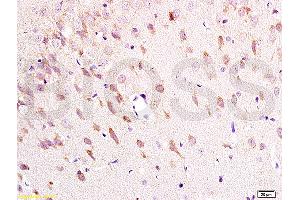 Formalin-fixed and paraffin embedded: rat brain tissue labeled with Anti-NK-2R Polyclonal Antibody (ABIN725315), Unconjugated at 1:200 followed by conjugation to the secondary antibody and DAB staining (TACR2 Antikörper  (AA 223-300))