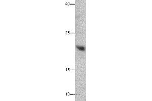 Western blot analysis of Mouse liver tissue, using GFER Polyclonal Antibody at dilution of 1:750 (GFER Antikörper)