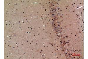 Immunohistochemistry (IHC) analysis of paraffin-embedded Mouse Brain, antibody was diluted at 1:100.