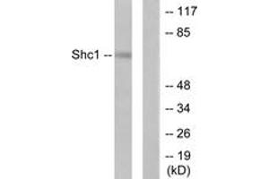 Western blot analysis of extracts from HeLa cells, treated with Calyculin A 50nM 15', using Shc (Ab-427) Antibody. (SHC1 Antikörper  (AA 393-442))