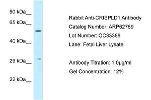 Western Blotting (WB) image for anti-Cysteine-Rich Secretory Protein LCCL Domain Containing 1 (CRISPLD1) (Middle Region) antibody (ABIN970458) (CRISPLD1 Antikörper  (Middle Region))