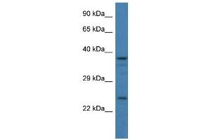 Western Blot showing GAP43 antibody used at a concentration of 1 ug/ml against 293T Cell Lysate (GAP43 Antikörper  (C-Term))