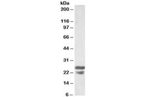 Western blot testing of mouse spleen lysates with ASC antibody at 0. (PYCARD Antikörper)