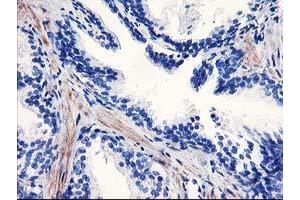 Immunohistochemical staining of paraffin-embedded Human prostate tissue using anti-PPARA mouse monoclonal antibody.