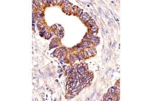 Immunohistochemical analysis of paraffin-embedded H.