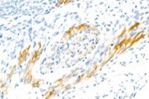 Immunohistochemistry analysis of paraffin-embedded rat embryo using CNTN5 (ABIN7073575) at dilution of 1: 2000 (Contactin 5 Antikörper)