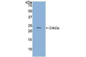 Western blot analysis of recombinant Human RGS4. (RGS4 Antikörper  (AA 38-205))