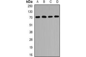 Western blot analysis of PEX5 expression in MCF7 (A), Hela (B), mouse liver (C), mouse kidney (D) whole cell lysates. (PEX5 Antikörper)