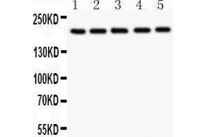 Western Blotting (WB) image for anti-Tuberous Sclerosis 2 (TSC2) (AA 1611-1807) antibody (ABIN3043498)