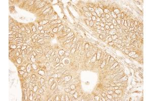 Immunohistochemistry (IHC) image for anti-Ran GTPase Activating Protein 1 (RANGAP1) (AA 400-450) antibody (ABIN7448754)