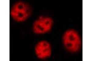 Immunofluorescence (fixed cells) (IF/ICC) image for anti-Protein tyrosine Phosphatase, Non-Receptor Type 11 (PTPN11) (pTyr580) antibody (ABIN6256769)