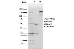SDS-PAGE Analysis of Purified p27 Mouse Monoclonal Antibody (SX53G8). (CDKN1B Antikörper)