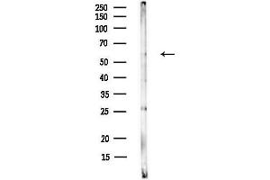 anti-Outer Dense Fiber of Sperm Tails 2-Like (ODF2L) (N-Term) antibody