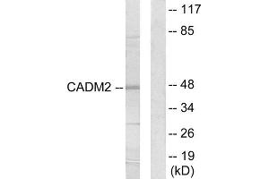 Western Blotting (WB) image for anti-Cell Adhesion Molecule 2 (CADM2) (Internal Region) antibody (ABIN1850234) (CADM2 Antikörper  (Internal Region))