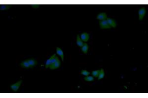 Detection of GSTp in Human MCF7 cell using Polyclonal Antibody to Glutathione S Transferase Pi (GSTp) (GSTP1 Antikörper  (AA 1-210))