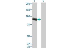 Western Blot analysis of TOP3B expression in transfected 293T cell line by TOP3B monoclonal antibody (M06), clone 2G2. (TOP3B Antikörper  (AA 1-862))