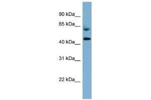 RMND1 antibody used at 1 ug/ml to detect target protein. (RMND1 Antikörper)