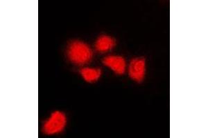 Immunofluorescent analysis of CDK1/2/3 (pT14) staining in HeLa cells. (CDK1/2/3 (N-Term), (pSer14) Antikörper)