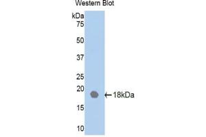 Western blot analysis of the recombinant protein. (IL18RAP Antikörper  (AA 117-240))