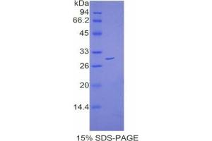 SDS-PAGE analysis of Mouse Catenin beta 1 Protein. (CTNNB1 Protein)