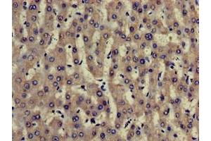 Immunohistochemistry of paraffin-embedded human liver tissue using ABIN7173904 at dilution of 1:100 (TRADD Antikörper  (AA 1-312))