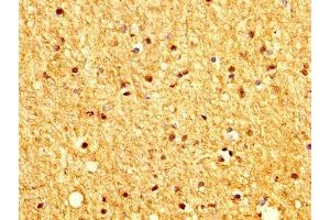 IHC image of ABIN7165907 diluted at 1:200 and staining in paraffin-embedded human brain tissue performed on a Leica BondTM system. (Patched 2 Antikörper  (AA 793-951))