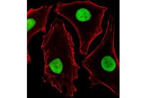 Fluorescent image of Hela cells stained with SUMO2 Antibody (C-term) B.