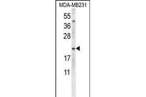 Western blot analysis of NEU1 Antibody (Center) (ABIN653650 and ABIN2842991) in MDA-M cell line lysates (35 μg/lane). (NEU1 Antikörper  (AA 11-40))
