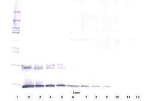 Image no. 2 for anti-Interleukin 5 (IL5) antibody (ABIN465636) (IL-5 Antikörper)