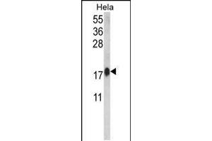 Western blot analysis of CALM1 Antibody in Hela cell line lysates (35ug/lane)(2ug/ml) (Calmodulin 1 Antikörper  (C-Term))