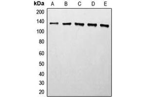 Western blot analysis of Histone Deacetylase 5 expression in MCF7 (A), Jurkat (B), HeLa (C), mouse liver (D), rat liver (E) whole cell lysates. (HDAC5 Antikörper  (C-Term))