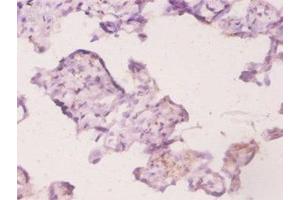Immunohistochemistry of paraffin-embedded human placenta tissue using ABIN7174460 at dilution of 1:20 (UBE2K Antikörper  (AA 2-200))