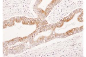 Immunohistochemistry (IHC) image for anti-Prostaglandin-Endoperoxide Synthase 2 (Prostaglandin G/H Synthase and Cyclooxygenase) (PTGS2) (AA 554-604) antibody (ABIN7454933)