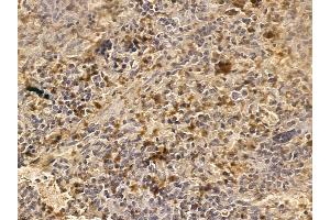 RIMS2 Mouse Monoclonal Antibody at 1/100 staining rat spleen tissue by IHC-P.