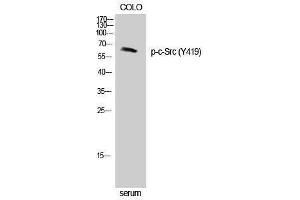 Western Blotting (WB) image for anti-Proto-oncogene tyrosine-protein kinase Src (Src) (pTyr419) antibody (ABIN3181976) (Src Antikörper  (pTyr419))