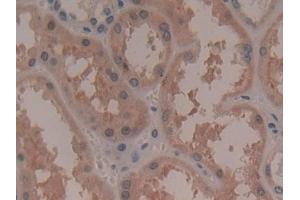 Immunohistochemistry (IHC) image for anti-Ribosomal Protein S6 Kinase, 90kDa, Polypeptide 1 (RPS6KA1) (AA 62-321) antibody (ABIN7441682)