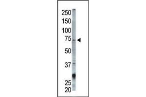 Western Blotting (WB) image for anti-Signal Transducing Adaptor Molecule (SH3 Domain and ITAM Motif) 1 (STAM) (AA 1-30), (N-Term) antibody (ABIN1882134)