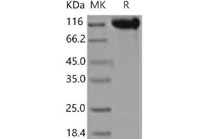 Western Blotting (WB) image for Selectin E (SELE) (Active) protein (Fc Tag) (ABIN7197868)