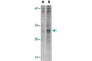 Western blot analysis of METTL7B in Jurkat cell lysate with METTL7B polyclonal antibody  at (A) 2 and (B) 4 ug/mL . (METTL7B Antikörper  (N-Term))