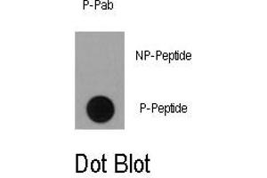 Image no. 1 for anti-Ribosomal Protein S6 Kinase, 90kDa, Polypeptide 1 (RPS6KA1) (pSer363) antibody (ABIN358393) (RPS6KA1 Antikörper  (pSer363))