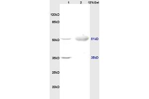 Lane 1: rat brain lysates Lane 2: human colon carcinoma lysates probed with Anti OLFM1/Noelin Polyclonal Antibody, Unconjugated (ABIN678308) at 1:200 in 4 °C. (Olfactomedin 1 Antikörper  (AA 101-200))