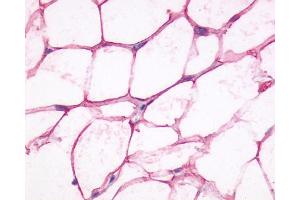 Staining of human adipocytes using SP4071 on paraffin sections (ADRB3 Antikörper  (Cytoplasmic Domain))