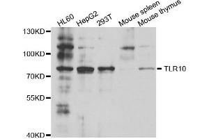 Western blot analysis of extracts of various cell lines, using TLR10 antibody. (TLR10 Antikörper)