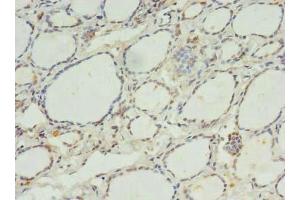 Immunohistochemistry of paraffin-embedded human thyroid tissue using ABIN7175073 at dilution of 1:100 (C11orf68 Antikörper  (AA 1-251))