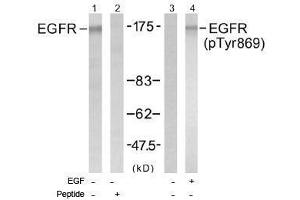 Image no. 1 for anti-Epidermal Growth Factor Receptor (EGFR) (pTyr869) antibody (ABIN196976) (EGFR Antikörper  (pTyr869))